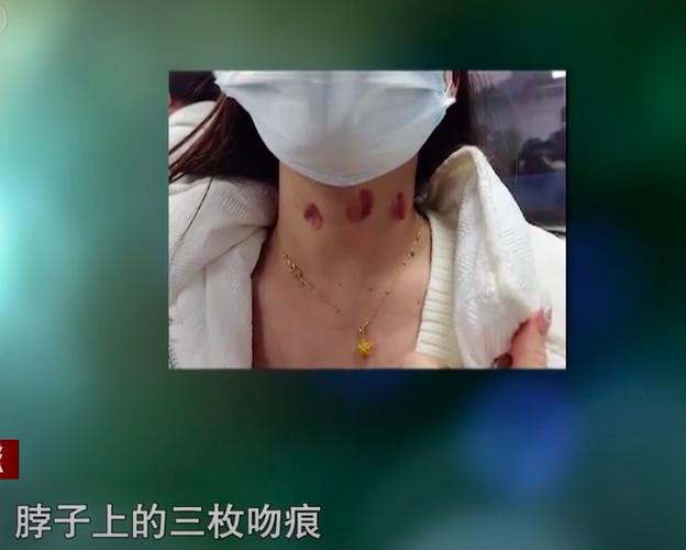 免费资料-资料大全和脖子被扎多根烧烤签与被烧烤签子扎出血了